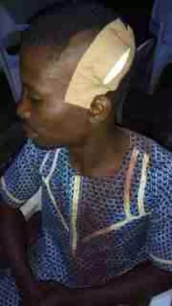 PDP Thugs Attack & Brutalise APC Members In Ejigbo, Osun State (Photos)